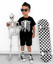 X-Ray